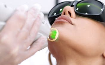 Лазерная эпиляция подбородка