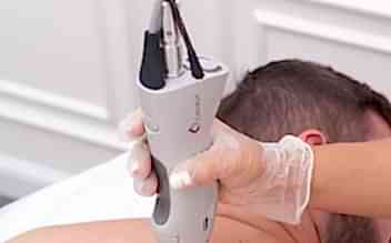 Эпиляция спины для мужчин