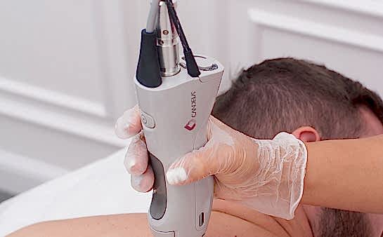 Эпиляция спины для мужчин