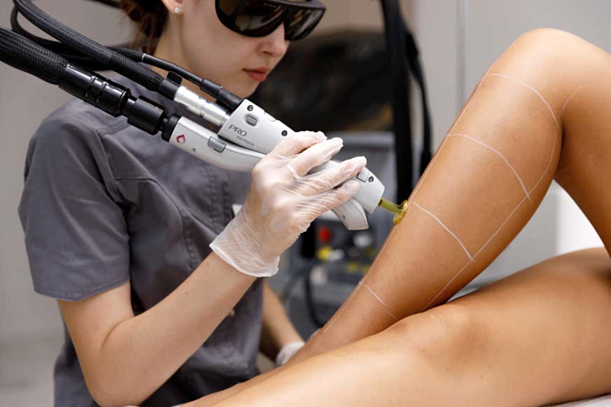 Сколько процедур нужно для полного удаления волос с помощью лазерной эпиляции?