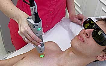 Лазерная эпиляция груди для мужчин