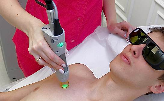 Лазерная эпиляция груди для мужчин