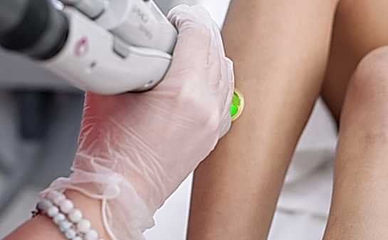 Лазерная эпиляция ног