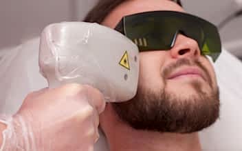 Лазерная эпиляция щёк для мужчин