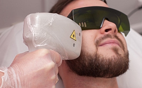 Лазерная эпиляция щёк для мужчин