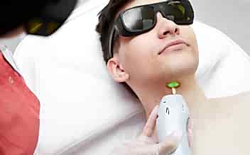 Лазерная эпиляция передней зоны шеи для мужчин