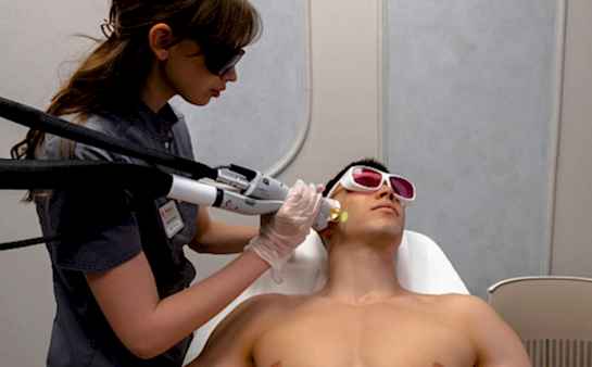 Лазерная эпиляция бороды для мужчин