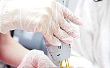 Лазерная эпиляция рук (до локтя)