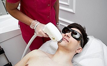 Лазерная эпиляция подбородка для мужчин