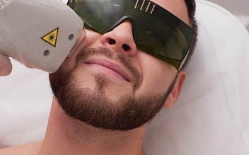 Лазерная эпиляция лица для мужчин