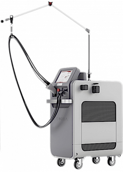 Candela GentleLase Pro-U