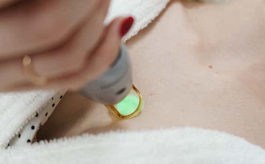 Лазерная эпиляция зоны декольте