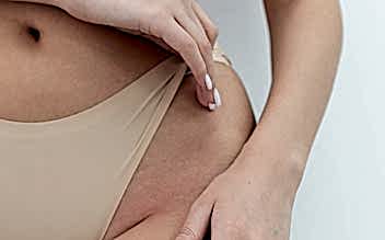 Лазерная эпиляция "Классическое бикини"