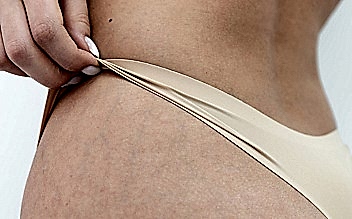 Лазерная эпиляция поясницы